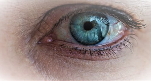 Eye Bags & Dark Circles